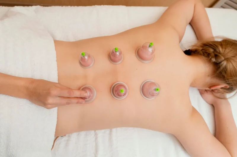 Esthetic Cupping for Cellulite & Face Lifts: Enhance Your Beauty through Traditional Techniques