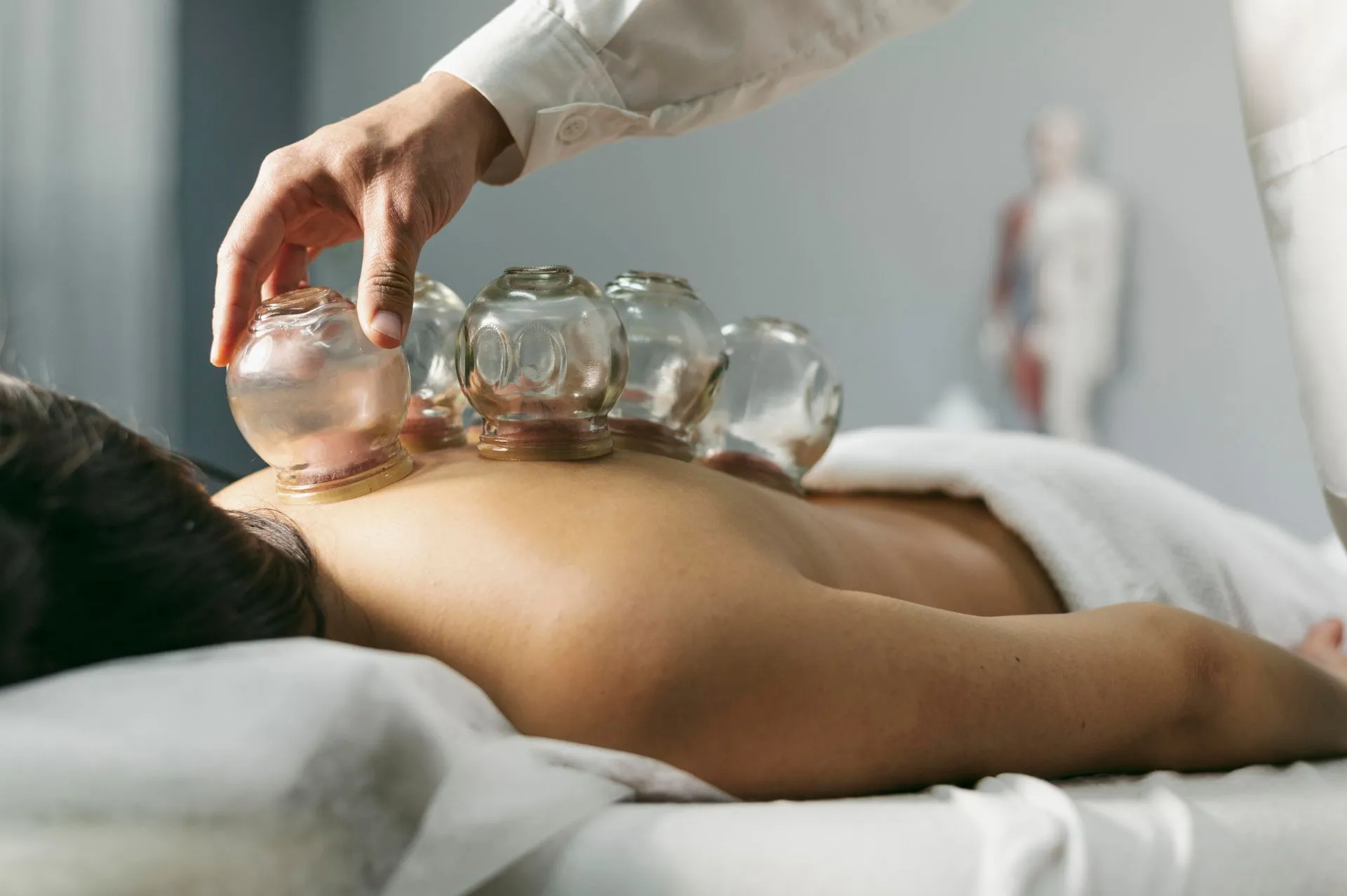 Cupping Therapy: An Ancient Technique for Today’s Modern World